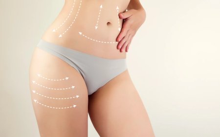 Smooth Healing After Surgery Tips from Best Liposuction Surgeon in Dubai