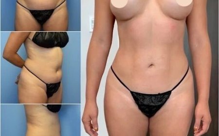 Best Body Contouring Surgeon in Dubai: Precision, Expertise, and Stunning Results
