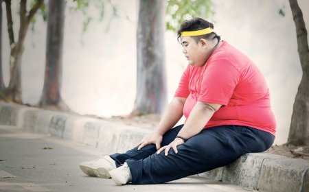 Improve Back Strength Affected by Obesity with Physio Help