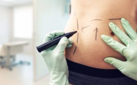 Abdominoplasty Dubai: How Long Do Results Really Last?