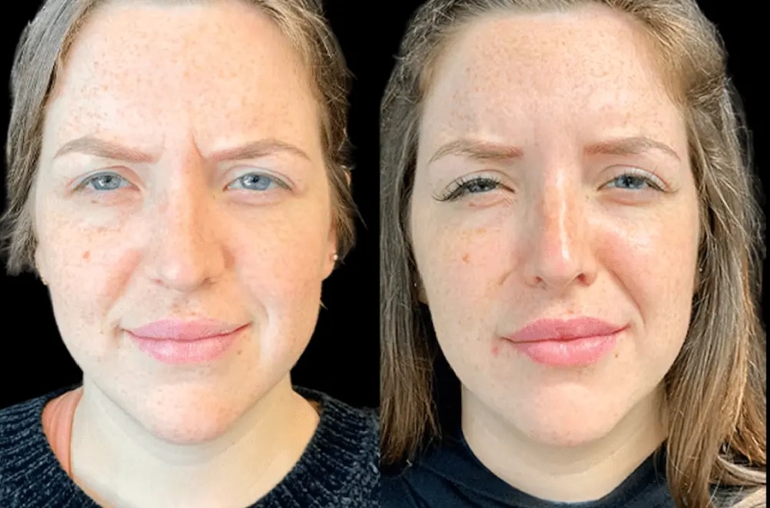 How the Best Aesthetic Clinic in Dubai is Redefining Skincare Standards