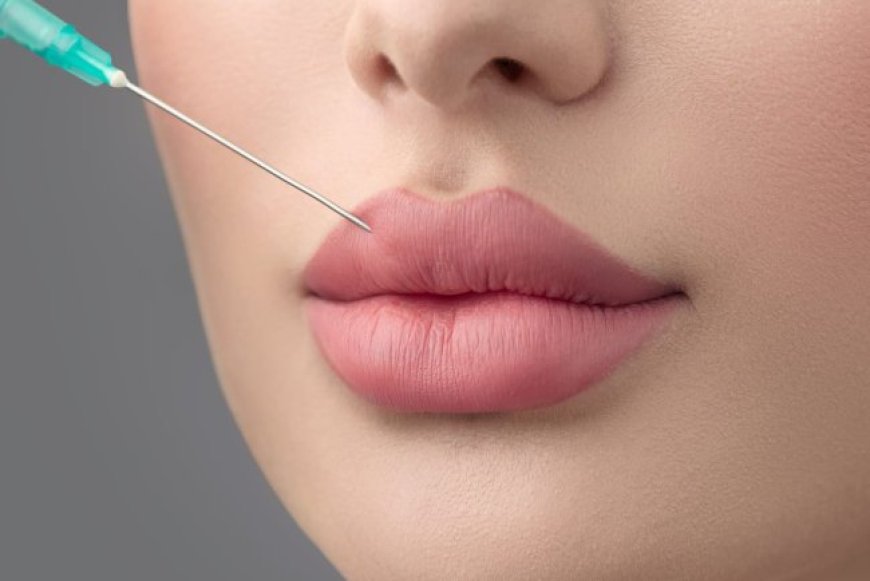 Russian Lip Fillers Treatment Process: What the Best Doctors in Dubai Want You to Know