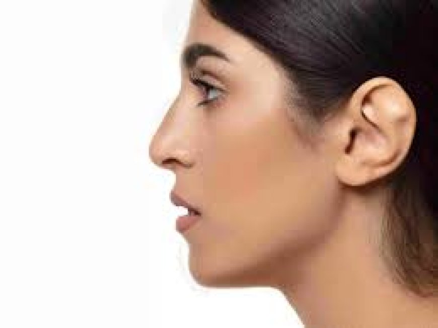Otoplasty in Jeddah: Reshape Your Ears with Confidence and Comfort