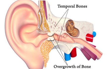 Feeling Dizzy? Here’s How Sinus Infection Vertigo Disrupts Your Life and What to Do About It