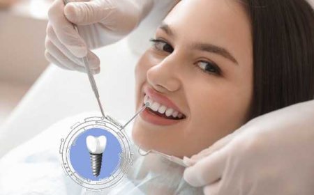 Achieve a Natural Smile with Dental Implants Over Dentures