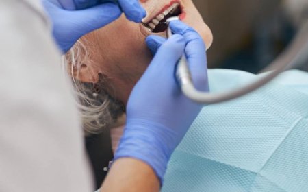 שיקום על גבי שתלים באשדוד – מראה צעיר ובריא לשיניים