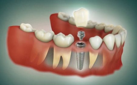 Hoe een Gezonde Glimlach Je Leven Kan Veranderen