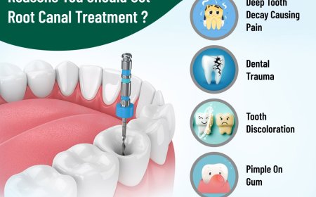 Root Canal Treatment in Hoodi Bangalore: What You Need to Know