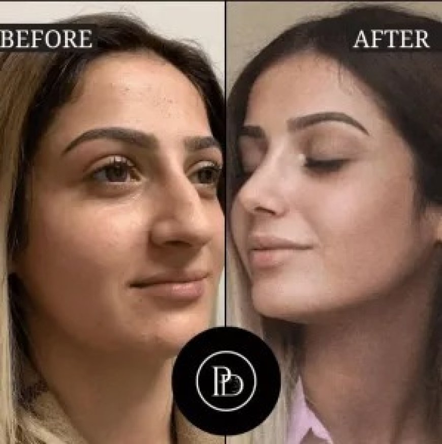 How PRP Treatment in Dubai is Redefining Anti-Aging