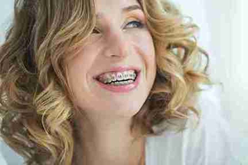 Achieving Smile Harmony Through Orthodontics in Armagh