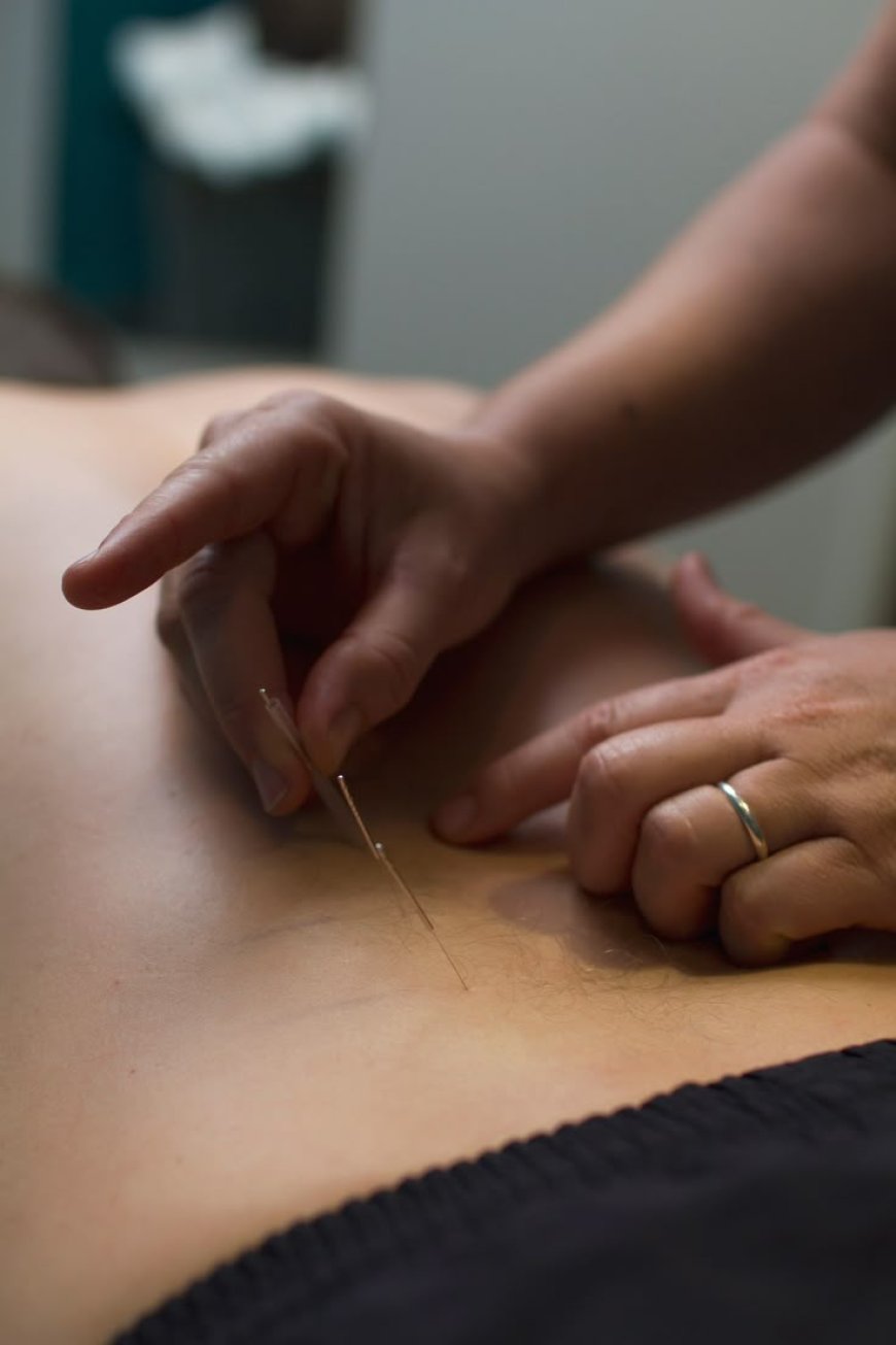 Acupuncture for Menopause Relief: A Natural Remedy for Hormonal Balance