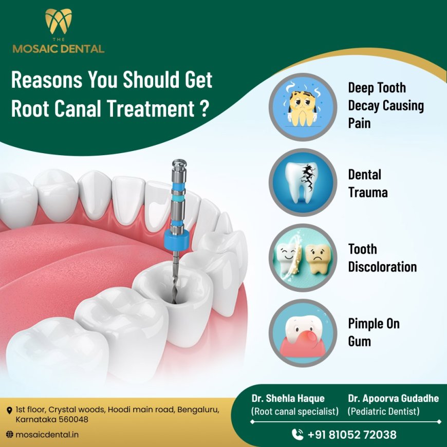 Root Canal Treatment in Hoodi Bangalore: What You Need to Know